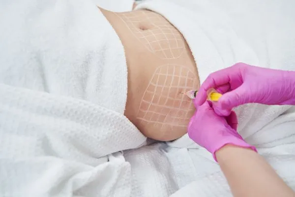 image of fat dissolving injections on love handles to help combat weight gain Feltham