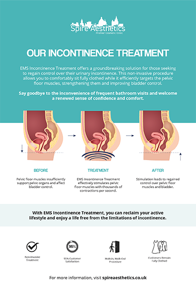 image of how urge incontinence Feltham treatment works