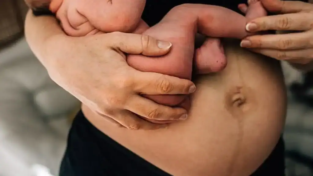 Why Is My Stomach Still Big After Pregnancy Feltham?